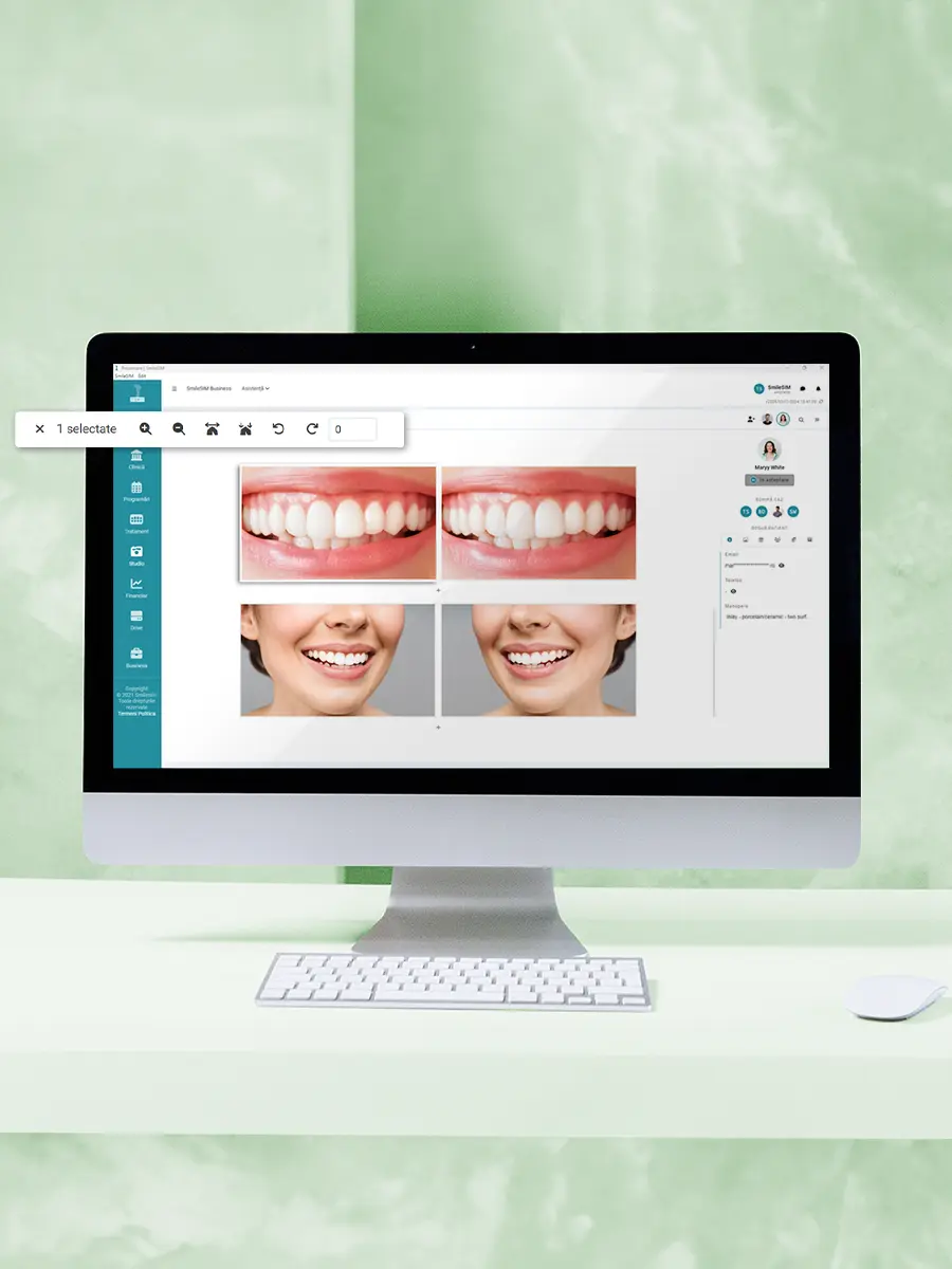 La función Edición de fotos del módulo de software {1}